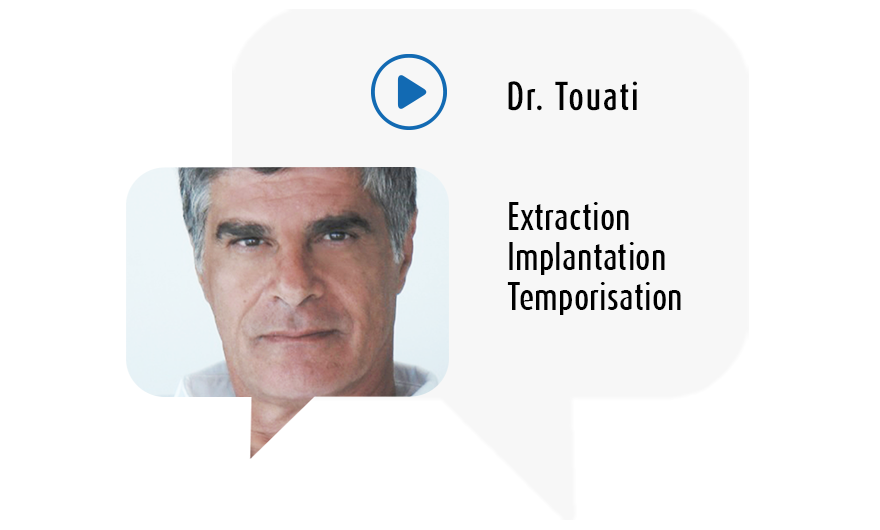 Extraction Implantation Temporisation