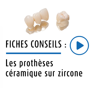 Prothèse dentaire protilab céramique sur zircone