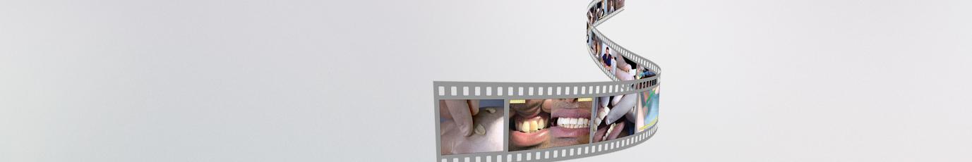 laboratoire prothèses dentaires protilab 