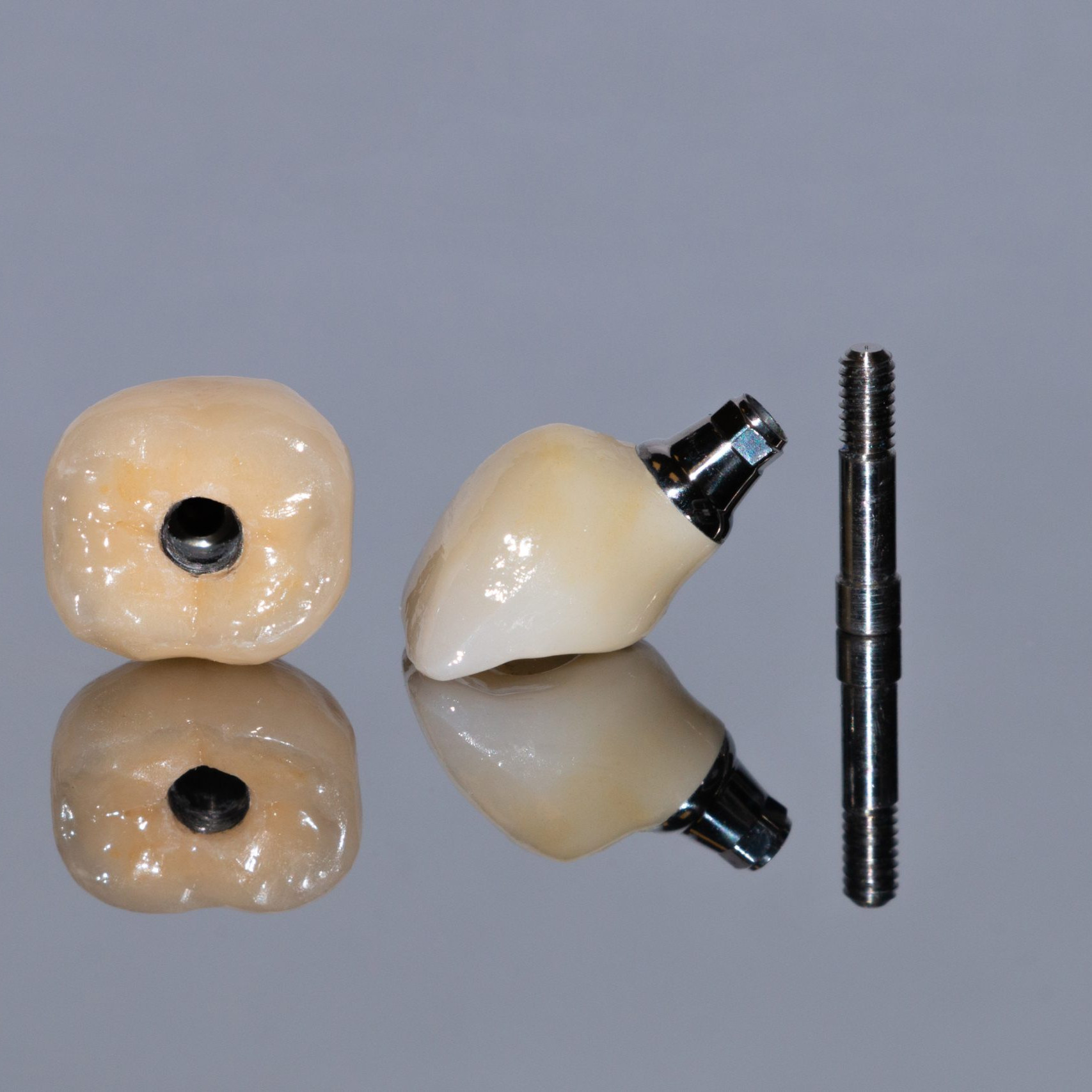 Couronne sur implant dentaire réalisée en flux numérique avec pilier implantaire et vis de fixation